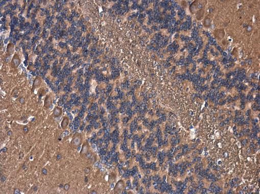 AKAP10 antibody [C3], C-term