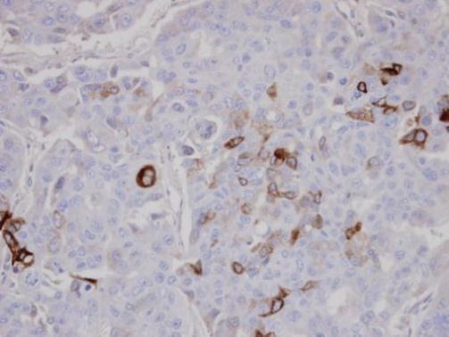 AKAP10 antibody [C3], C-term