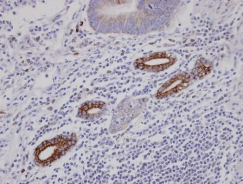 AKAP10 antibody [C3], C-term