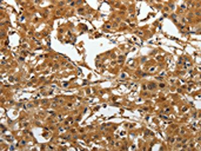 AKAP12 Antibody