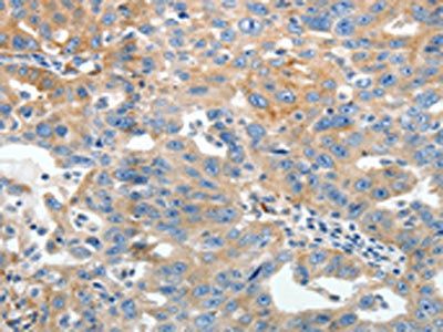 AKAP12 Antibody
