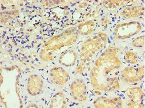 AKAP13 Antibody