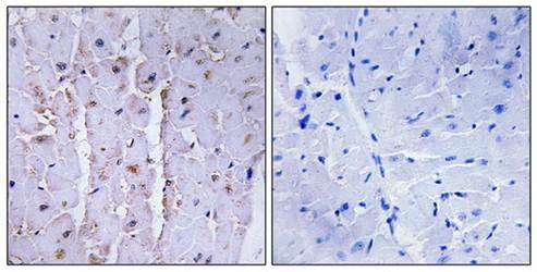 AKAP13 antibody