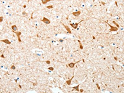 AKAP4 Antibody