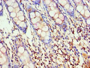 AKAP5 Antibody