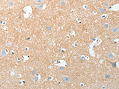 AKAP7 Antibody