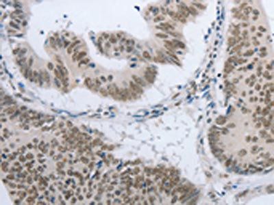 AKAP8 Antibody