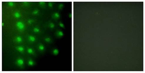 AKAP8 Antibody