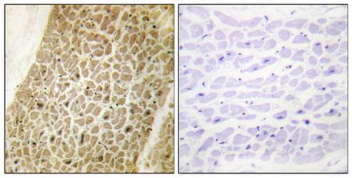 AKAP8 Antibody