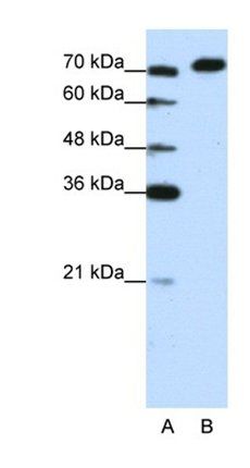 AKAP8L antibody