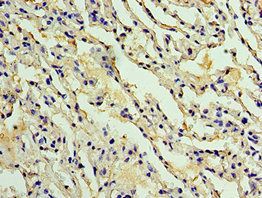 AKAP8L Antibody