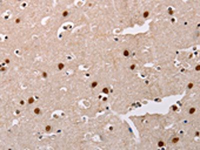 AKAP8L Antibody