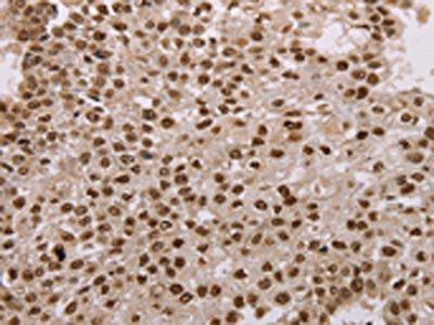 AKAP8L Antibody