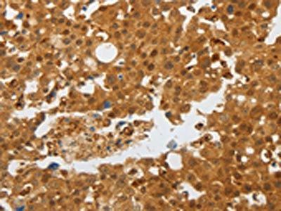 AKAP8L Antibody