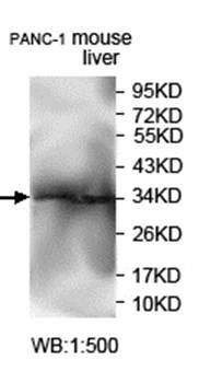 AKIRIN2 Rabbit Polyclonal Antibody