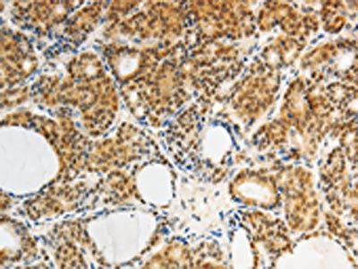AKR1A1 Antibody