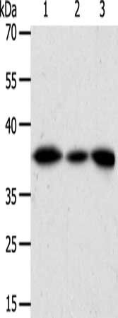 AKR1A1 antibody