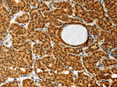 AKR1A1 Antibody
