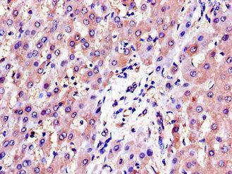 AKR1B1 Antibody