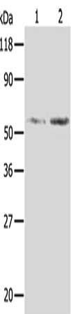 AKR1B1 Antibody