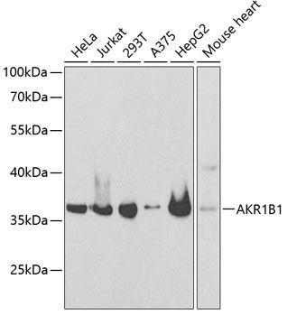 AKR1B1 antibody