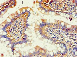 AKR1B10 Antibody