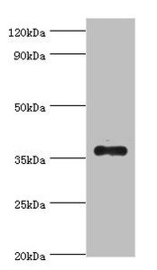 AKR1B10 Antibody