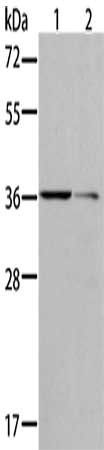 AKR1B10 antibody