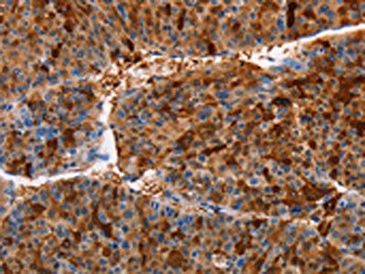 AKR1B10 antibody