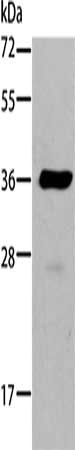 AKR1B10 antibody