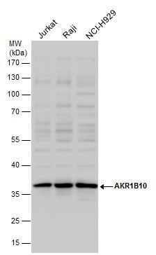 AKR1B10 antibody