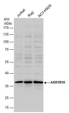 aldo-keto reductase family 1 member B10 Antibody