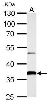 aldo-keto reductase family 1 member B10 Antibody