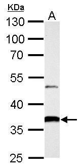 AKR1B10 antibody