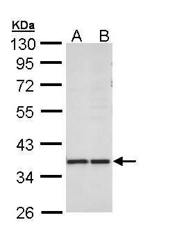 AKR1B10 antibody