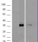 Goat anti-AKR1B10 Antibody