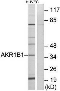 AKR1B1 Antibody