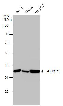 aldo-keto reductase family 1 member C1 Antibody