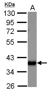 aldo-keto reductase family 1 member C1 Antibody