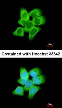 AKR1C1 Rabbit Polyclonal Antibody
