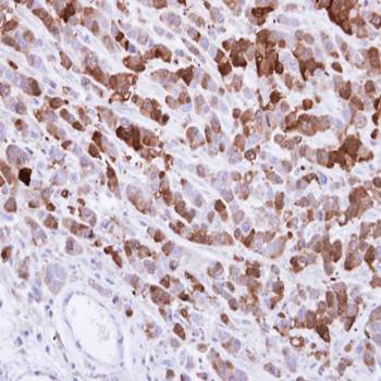 AKR1C1 Rabbit Polyclonal Antibody