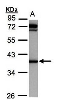 AKR1C1 Rabbit Polyclonal Antibody