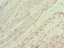 AKR1C3 Antibody