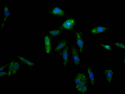 AKR1C3 Recombinant Monoclonal Antibody