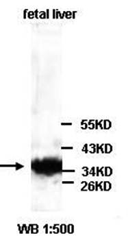 AKR1C3 antibody
