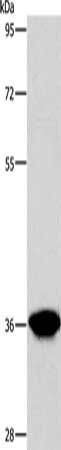 AKR1D1 Antibody