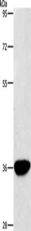 AKR1D1 Antibody