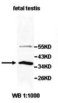 AKR1E2 Rabbit Polyclonal Antibody