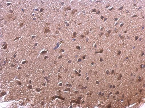 AKR7A2 antibody