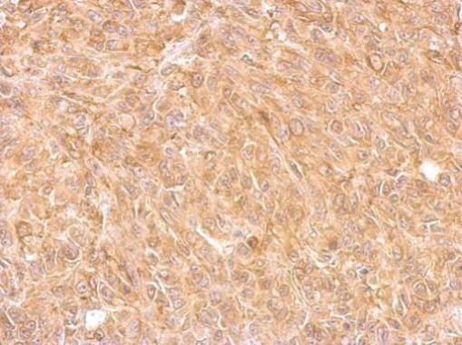 AKR7A2 antibody